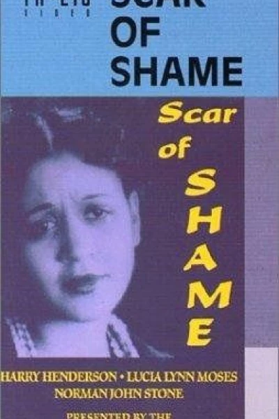 The Scar of Shame