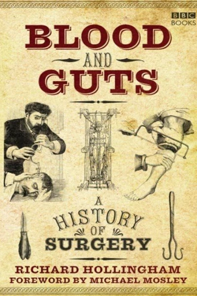 Blood and Guts: A History of Surgery